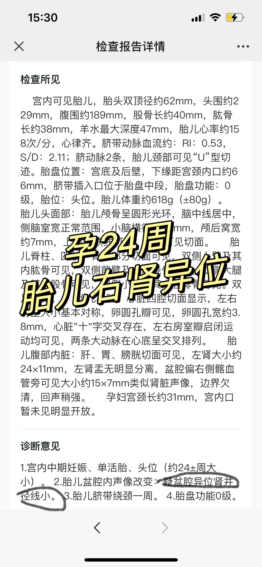 孕24周四维检查发现胎儿肾脏畸形，试管代孕产子网分享经验与应对